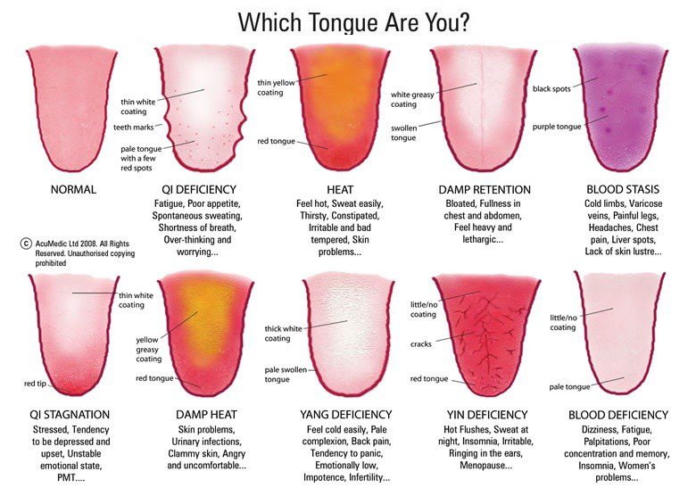 Different tongue profiles and what they mean. (chart)