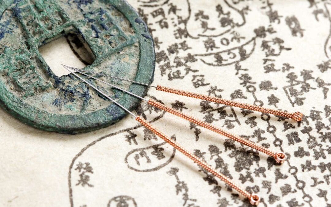 How To Get the Most Out of Your Acupuncture Treatment