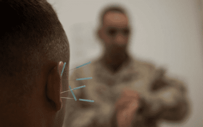 What to Know About Battlefield Acupuncture